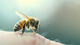 Was tun bei einem Bienenstich bzw. Wespenstich?