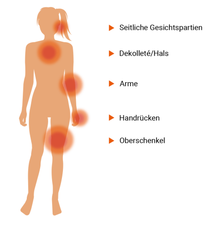 Sonnenallergie: Diese Stellen